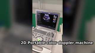 เครื่องดอปเปลอร์สีแบบพกพา US15 Plus 2D