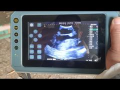 เครื่องอัลตราซาวนด์สัตวแพทย์แบบพกพา BR-VET8