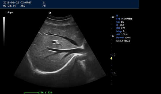 Medical Ultrasound Device 4D Portable Color Doppler Machine