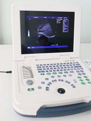 Full-digital laptop Ultrasound Diagnostic System 80element
