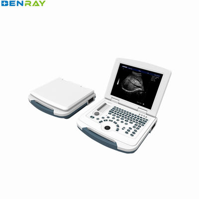 องค์ประกอบ Ultrasound Diagnostic System 96 แล็ปท็อปแบบดิจิตอลเต็มรูปแบบ